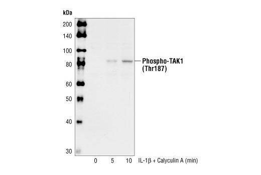 Western Blotting Image 1: Phospho-TAK1 (Thr187) Antibody
