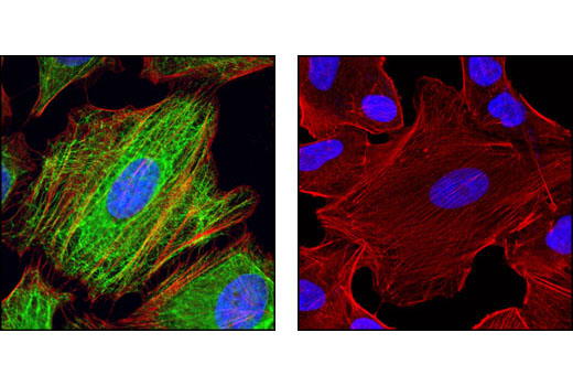 Immunofluorescence Image 1: Keratin 17 (D73C7) Rabbit mAb