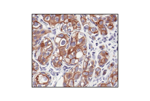 Immunohistochemistry Image 2: Pan-Keratin (C11) Mouse mAb