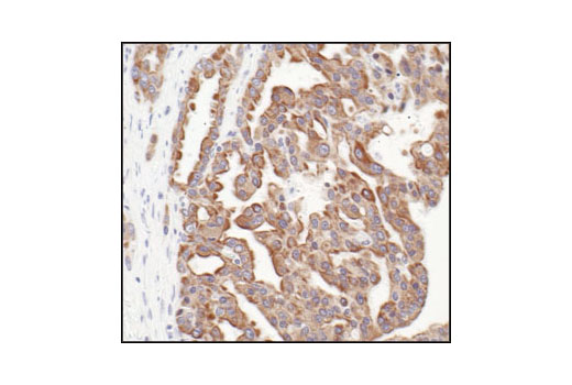 Immunohistochemistry Image 4: Pan-Keratin (C11) Mouse mAb