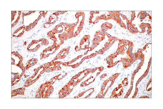 Immunohistochemistry Image 6: Pan-Keratin (C11) Mouse mAb
