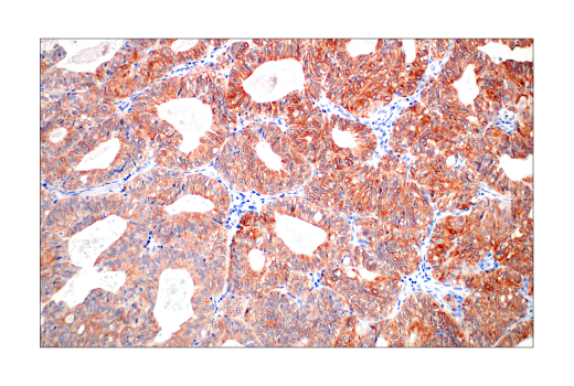 Immunohistochemistry Image 7: Pan-Keratin (C11) Mouse mAb
