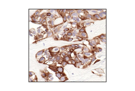 Immunohistochemistry Image 4: Keratin 8/18 (C51) Mouse mAb