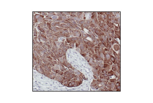 Immunohistochemistry Image 5: Keratin 8/18 (C51) Mouse mAb