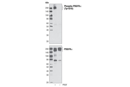 Western Blotting Image 1: Phospho-PDGF Receptor α (Tyr1018) Antibody