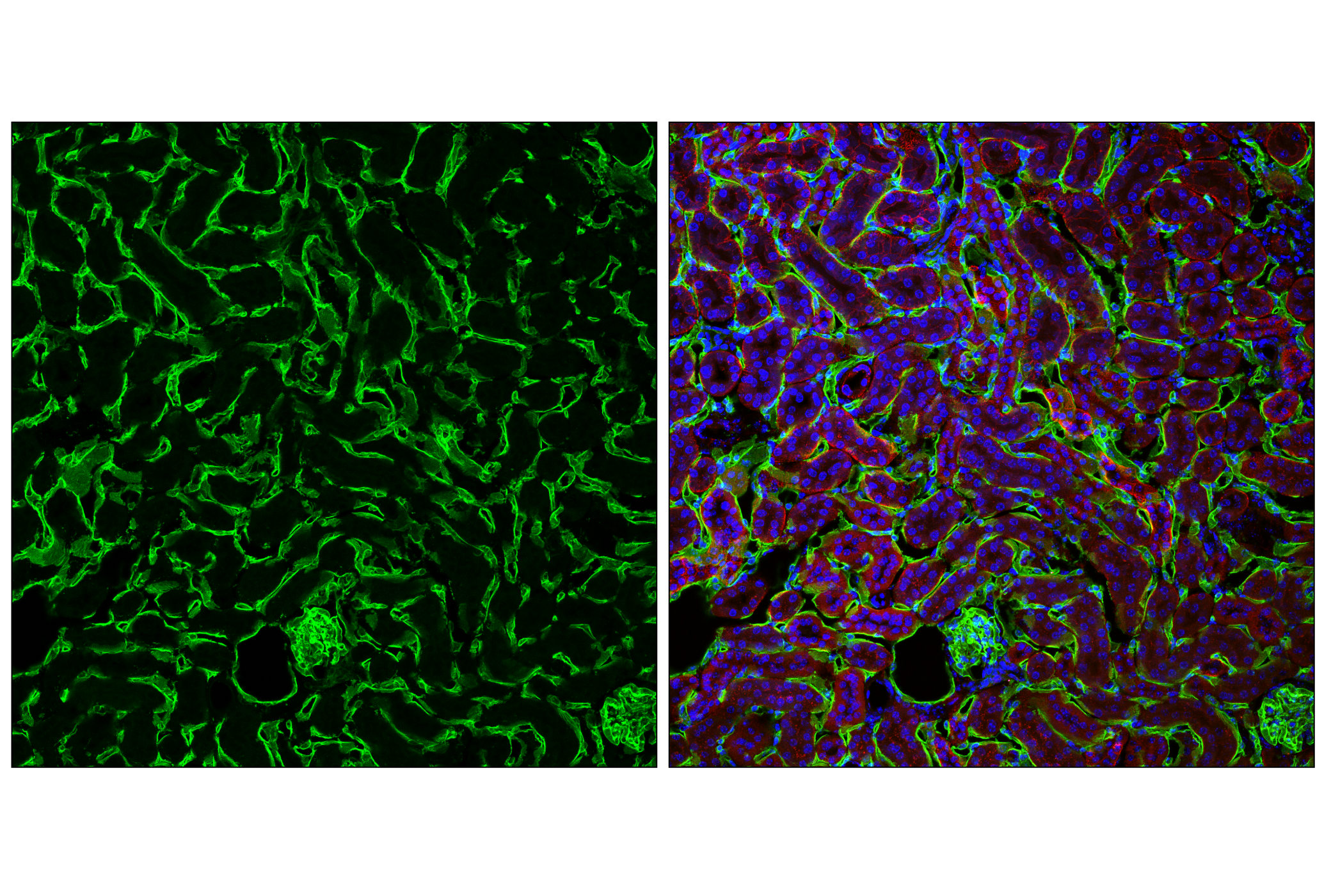 Immunofluorescence Image 1: EMCN (E2Z7L) Rabbit mAb