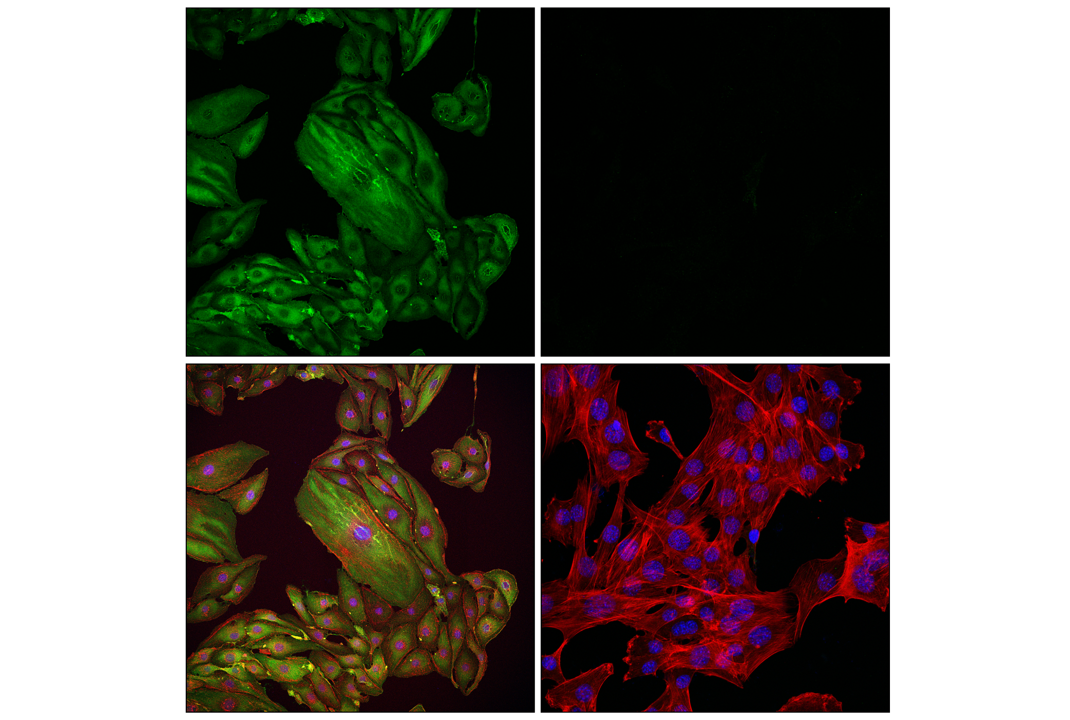 Immunofluorescence Image 2: EMCN (E2Z7L) Rabbit mAb