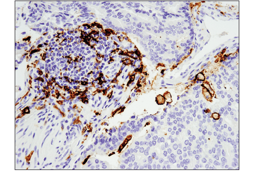  Image 13: Human Reactive M1 vs M2 Macrophage IHC Antibody Sampler Kit
