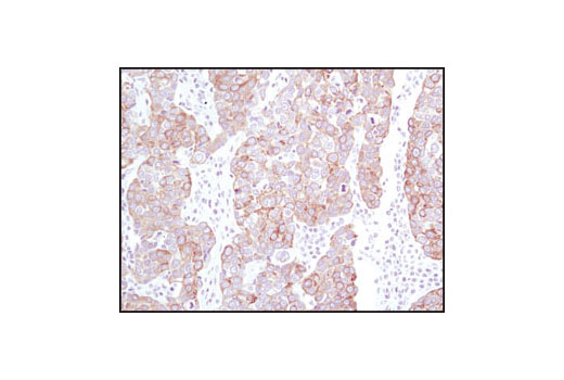 Immunohistochemistry Image 1: Keratin 19 (BA17) Mouse mAb