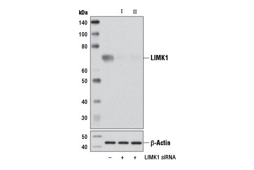  Image 1: SignalSilence® LIMK1 siRNA I