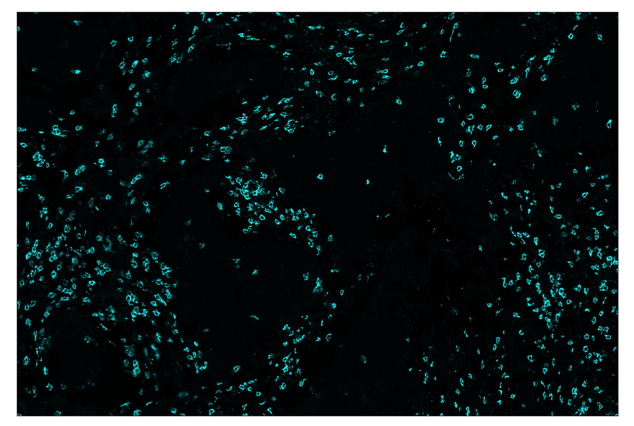 Immunohistochemistry Image 5: CD8α (D8A8Y) & CO-0004-488 SignalStar™ Oligo-Antibody Pair