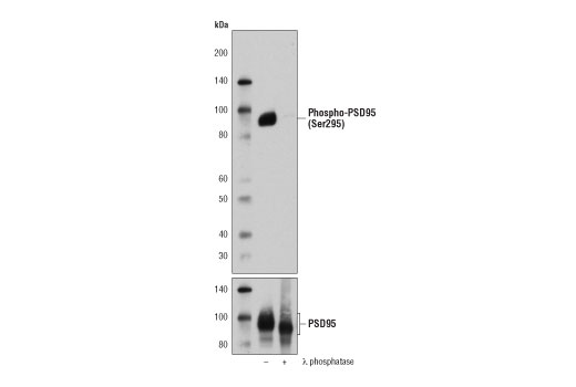  Image 4: PhosphoPlus® PSD95 (Ser295) Antibody Duet