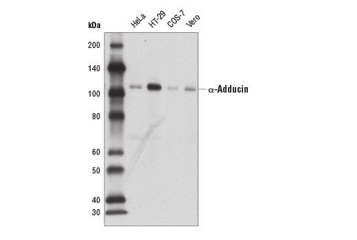 Western Blotting Image 1: α-Adducin Antibody