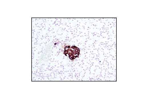 Immunohistochemistry Image 1: Insulin Antibody