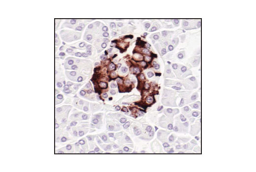 Immunohistochemistry Image 3: Insulin Antibody