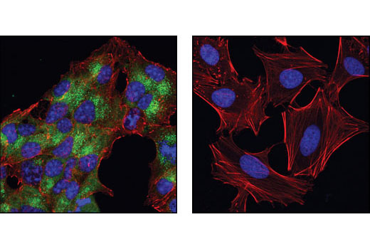 Immunofluorescence Image 2: Insulin Antibody