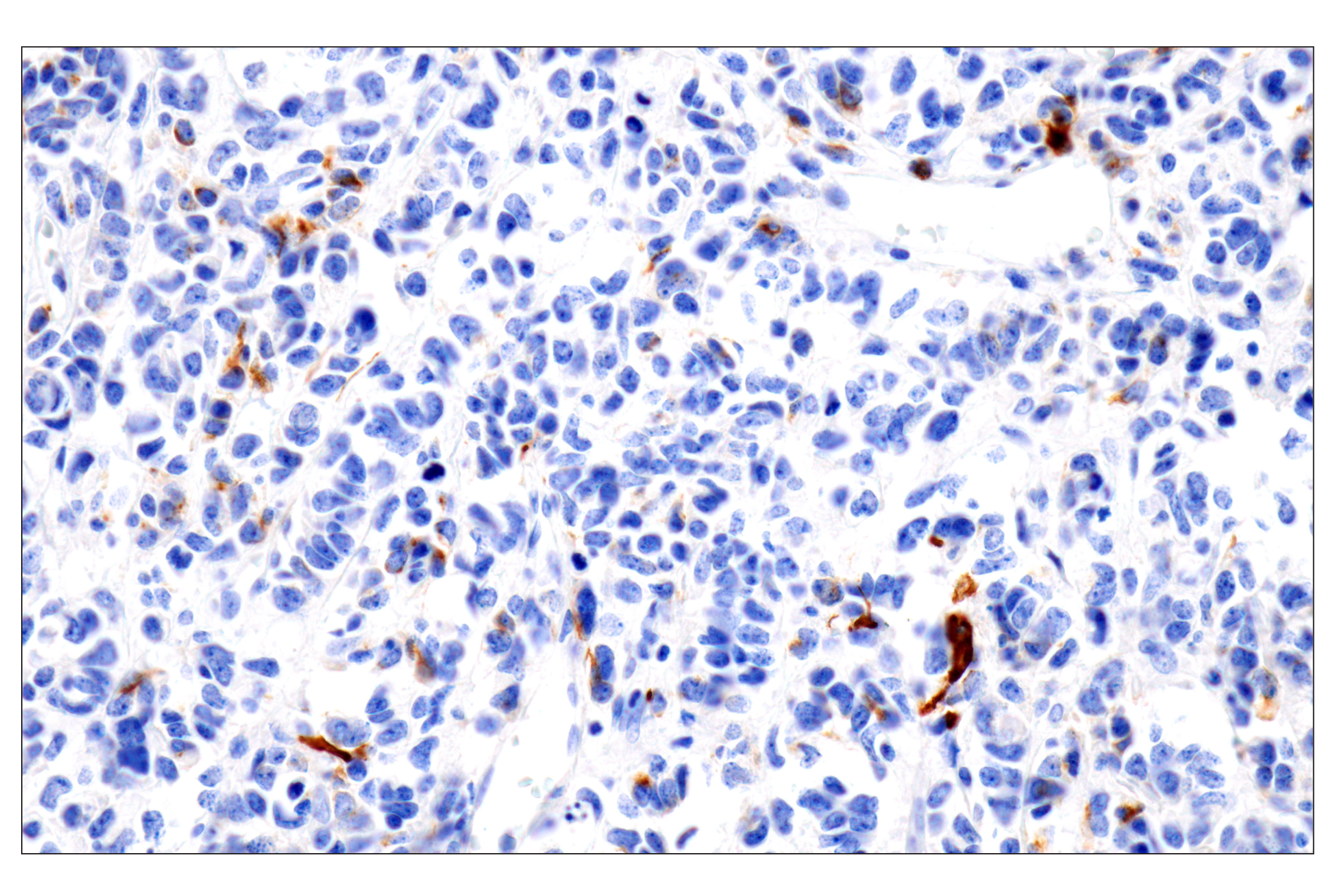 Immunohistochemistry Image 2: GFAP (E4L7M) XP® Rabbit mAb (BSA and Azide Free)