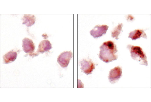 Immunohistochemistry Image 3: LC3A (D50G8) XP® Rabbit mAb