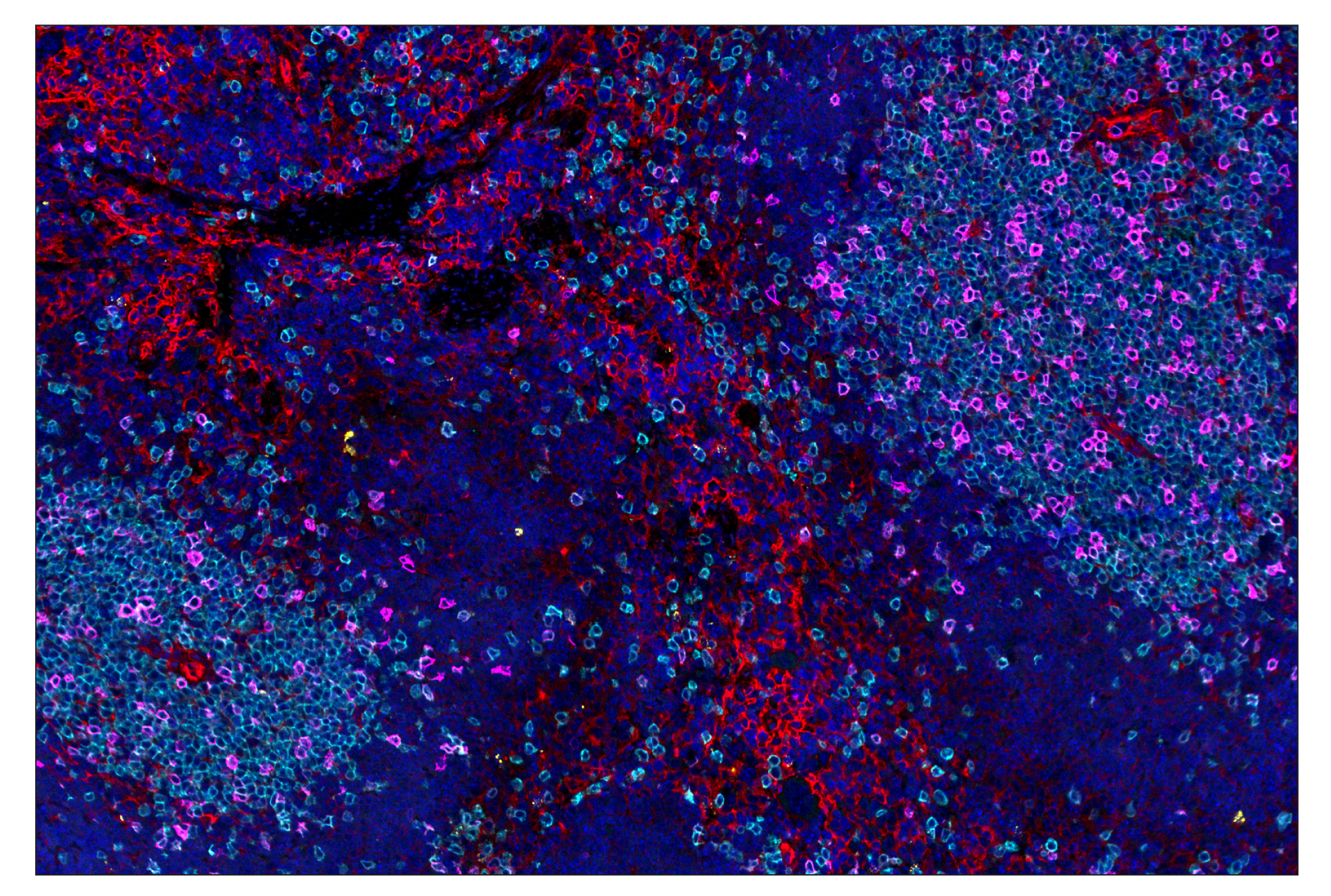 Immunohistochemistry Image 8: IL-2Rα/CD25 (E9W2J) & CO-0074-594 SignalStar™ Oligo-Antibody Pair