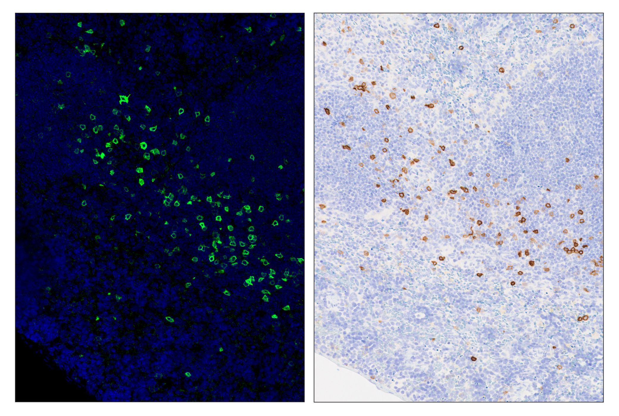 Immunohistochemistry Image 6: IL-2Rα/CD25 (E9W2J) & CO-0074-488 SignalStar™ Oligo-Antibody Pair