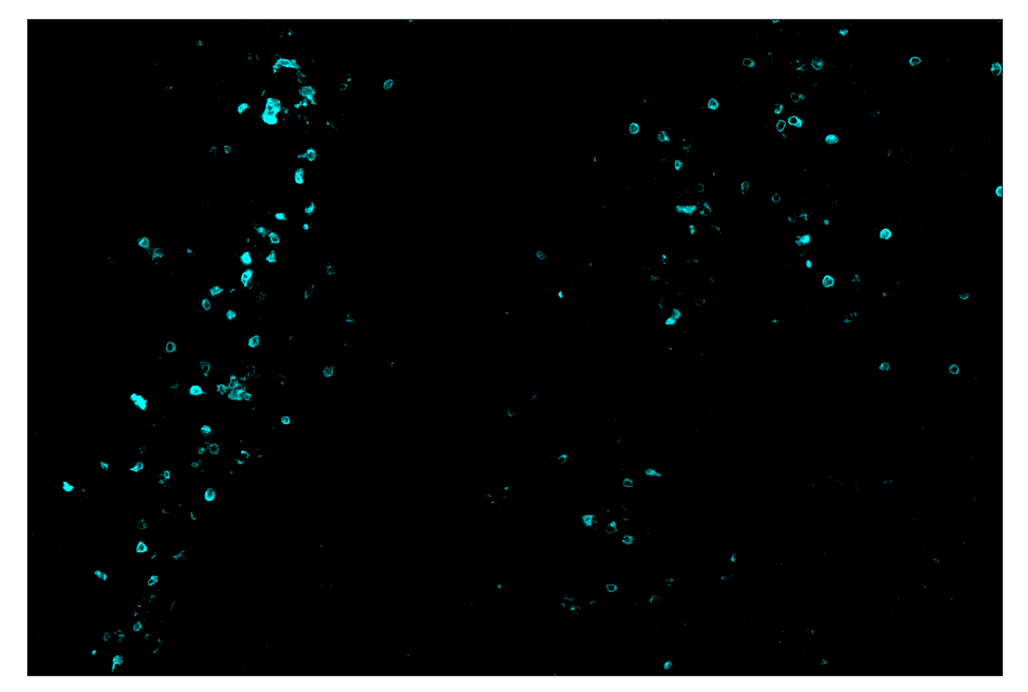 Immunohistochemistry Image 5: IL-2Rα/CD25 (E9W2J) & CO-0074-488 SignalStar™ Oligo-Antibody Pair