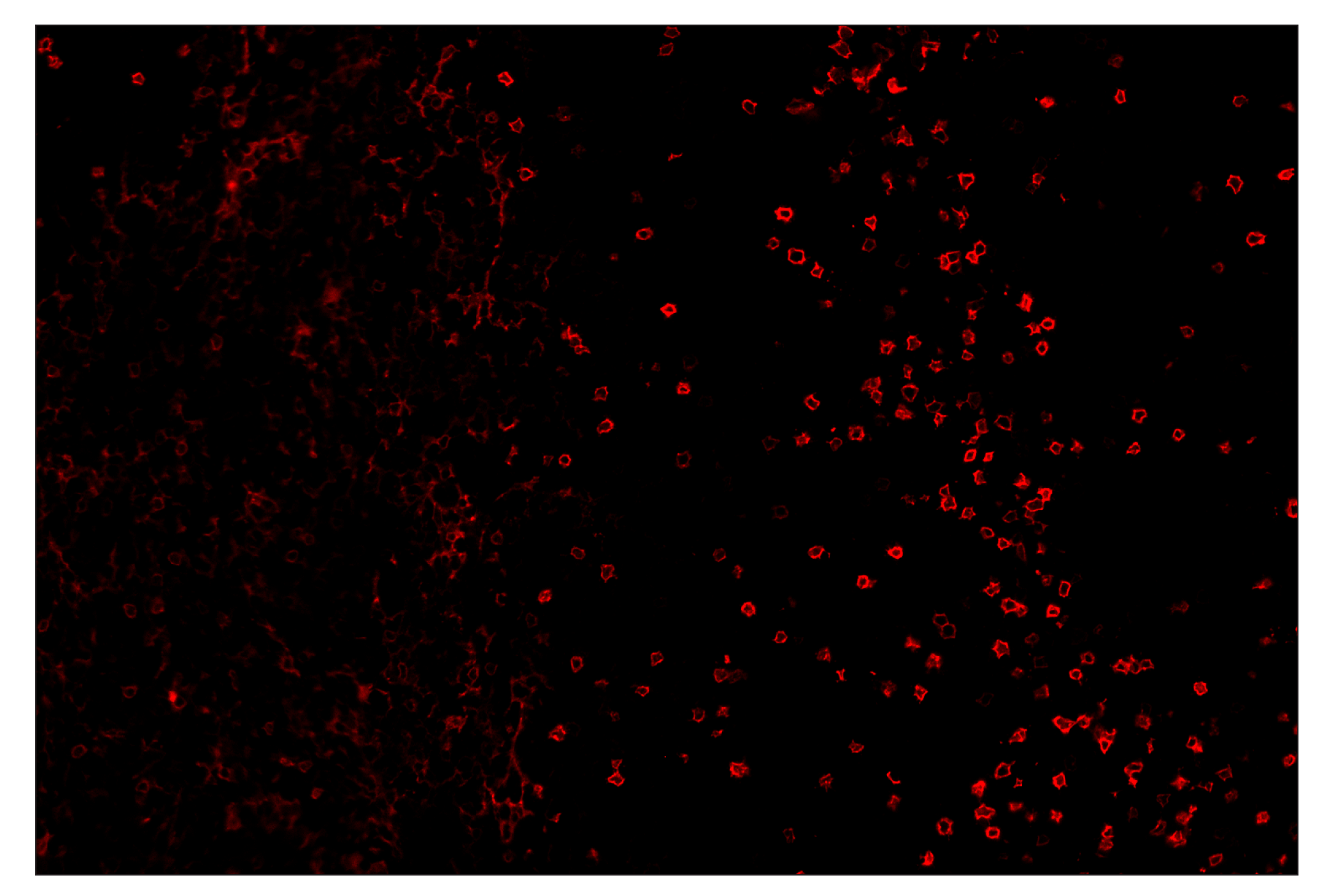Immunohistochemistry Image 4: IL-2Rα/CD25 (E9W2J) & CO-0074-594 SignalStar™ Oligo-Antibody Pair