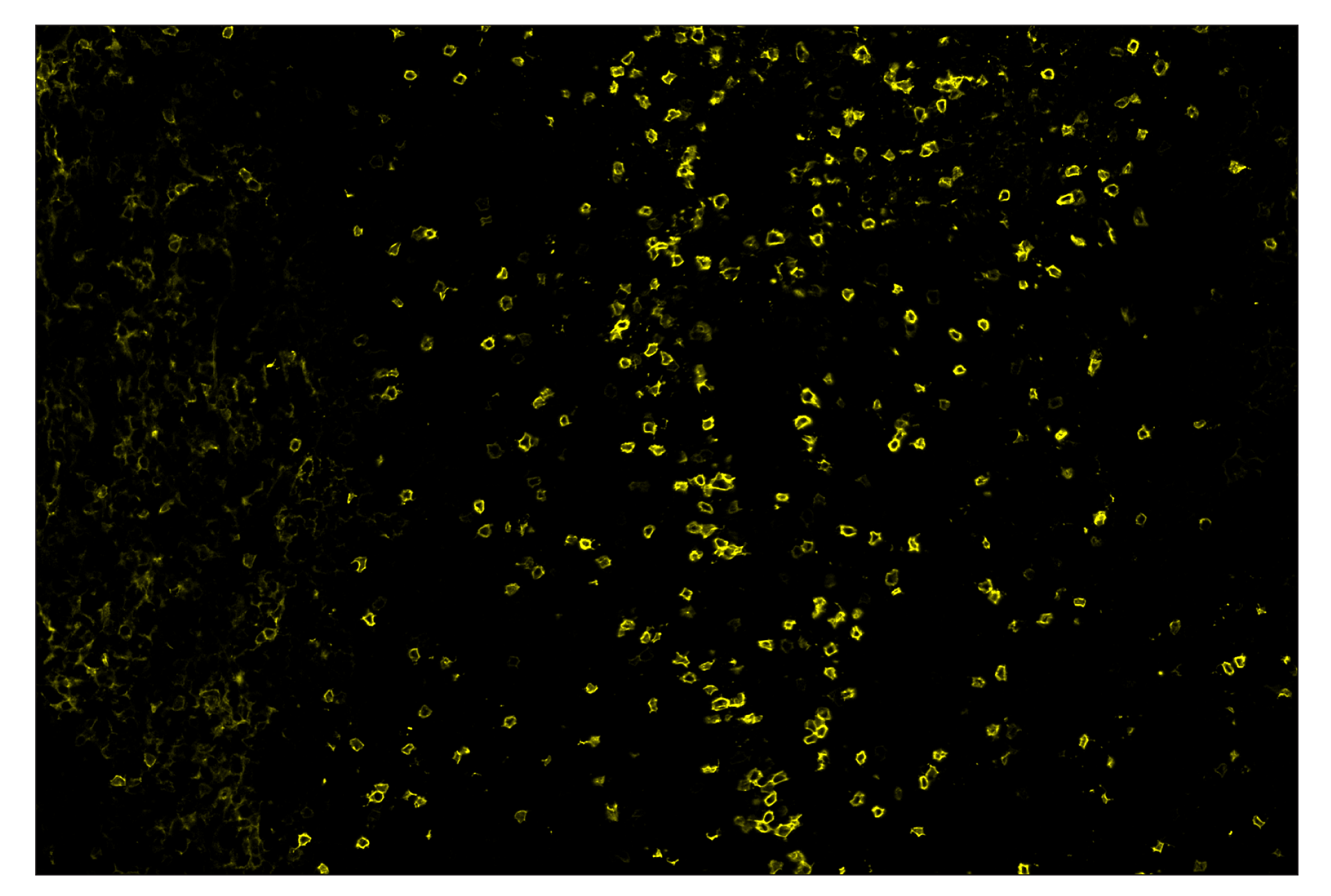 Immunohistochemistry Image 3: IL-2Rα/CD25 (E9W2J) & CO-0074-488 SignalStar™ Oligo-Antibody Pair