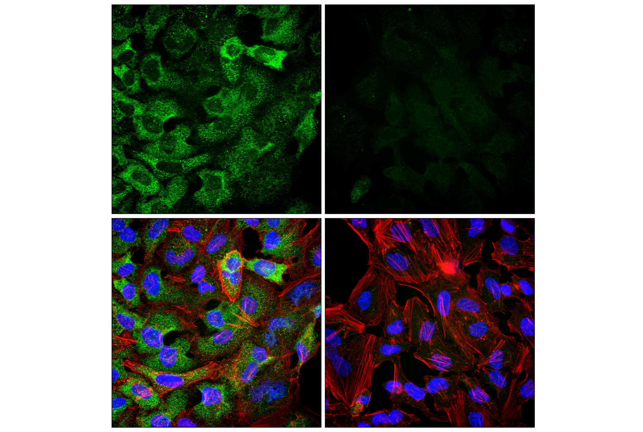 Immunofluorescence Image 1: eIF3B (F1E6A) Rabbit mAb