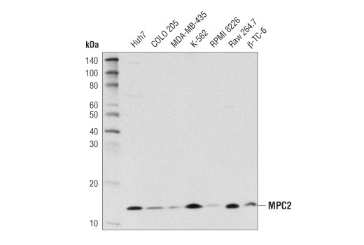  Image 7: Tricarboxylic Acid Cycle Antibody Sampler Kit