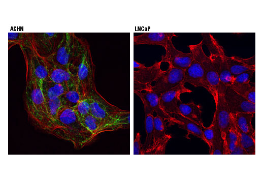 Immunofluorescence Image 1: Cavin-1 (D8C1D) Rabbit mAb