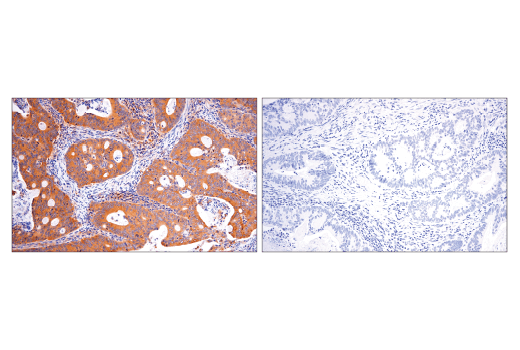 Immunohistochemistry Image 3: Rab5A (E6N8S) Mouse mAb