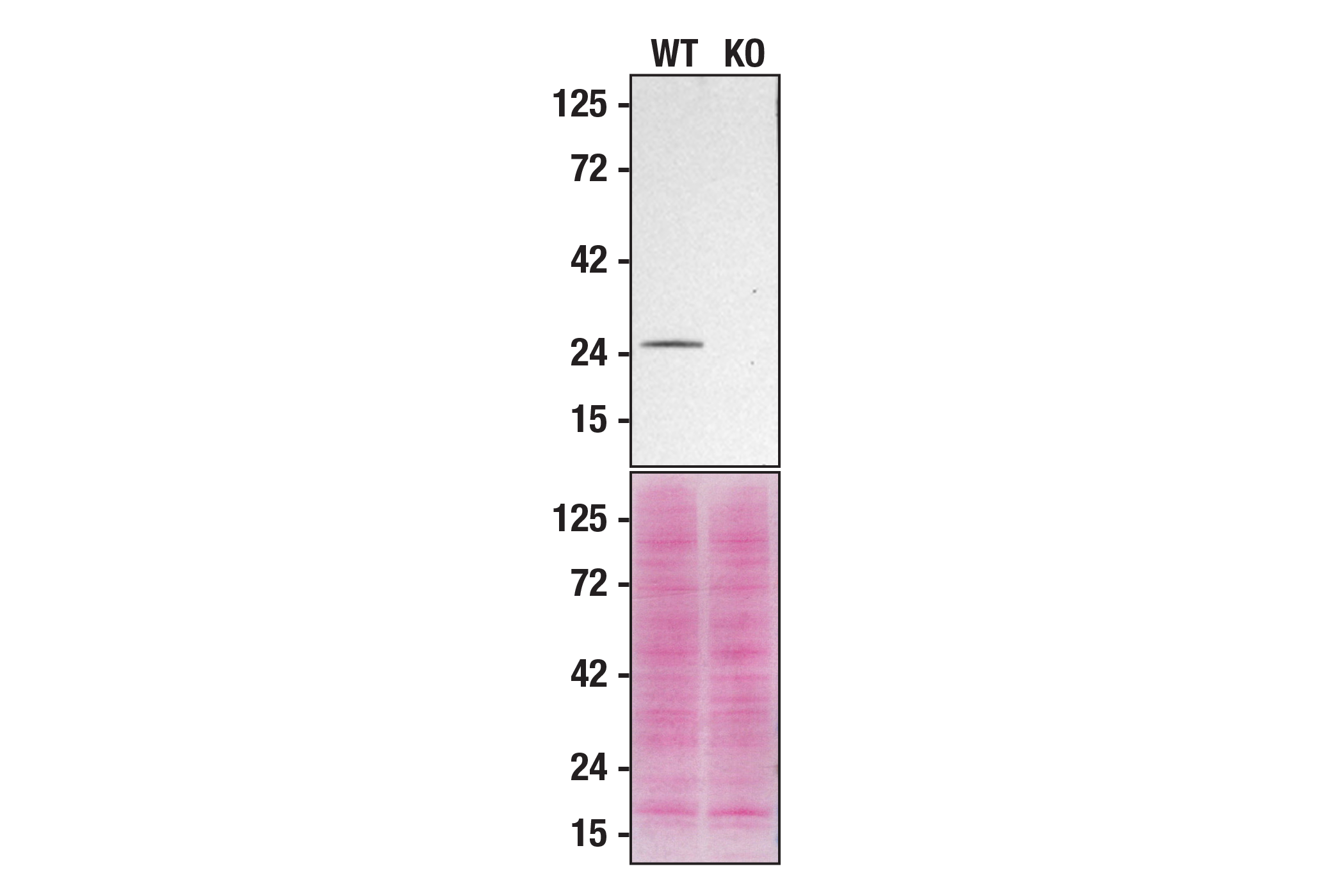  Image 17: Endosomal Marker Antibody Sampler Kit