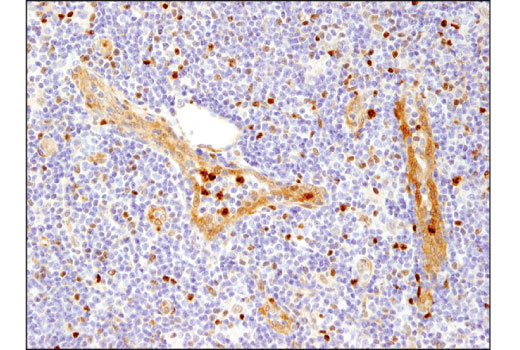 Immunohistochemistry Image 2: HSP70 (D1M6J) Mouse mAb