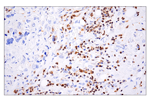 Immunohistochemistry Image 3: HPK1 (E1C3L) Rabbit mAb (BSA and Azide Free)