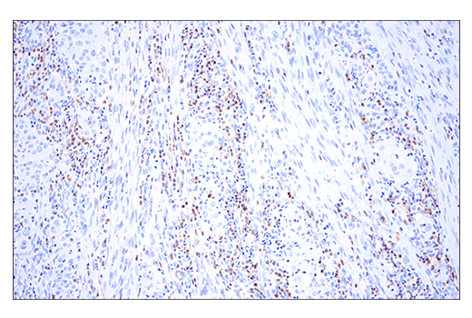 Immunohistochemistry Image 4: HPK1 (E1C3L) Rabbit mAb (BSA and Azide Free)