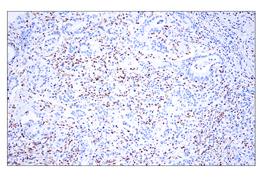 Immunohistochemistry Image 5: HPK1 (E1C3L) Rabbit mAb (BSA and Azide Free)