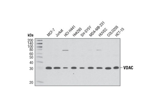  Image 9: Mitochondrial Marker Antibody Sampler Kit