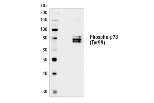 Western Blotting Image 1: Phospho-p73 (Tyr99) Antibody