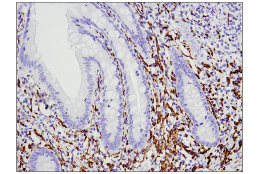  Image 11: PhosphoPlus® Tau (Ser404) Antibody Duet