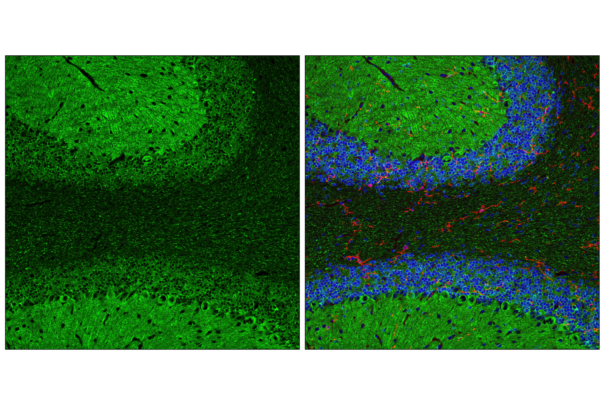 Immunofluorescence Image 1: Tau (D1M9X) XP® Rabbit mAb