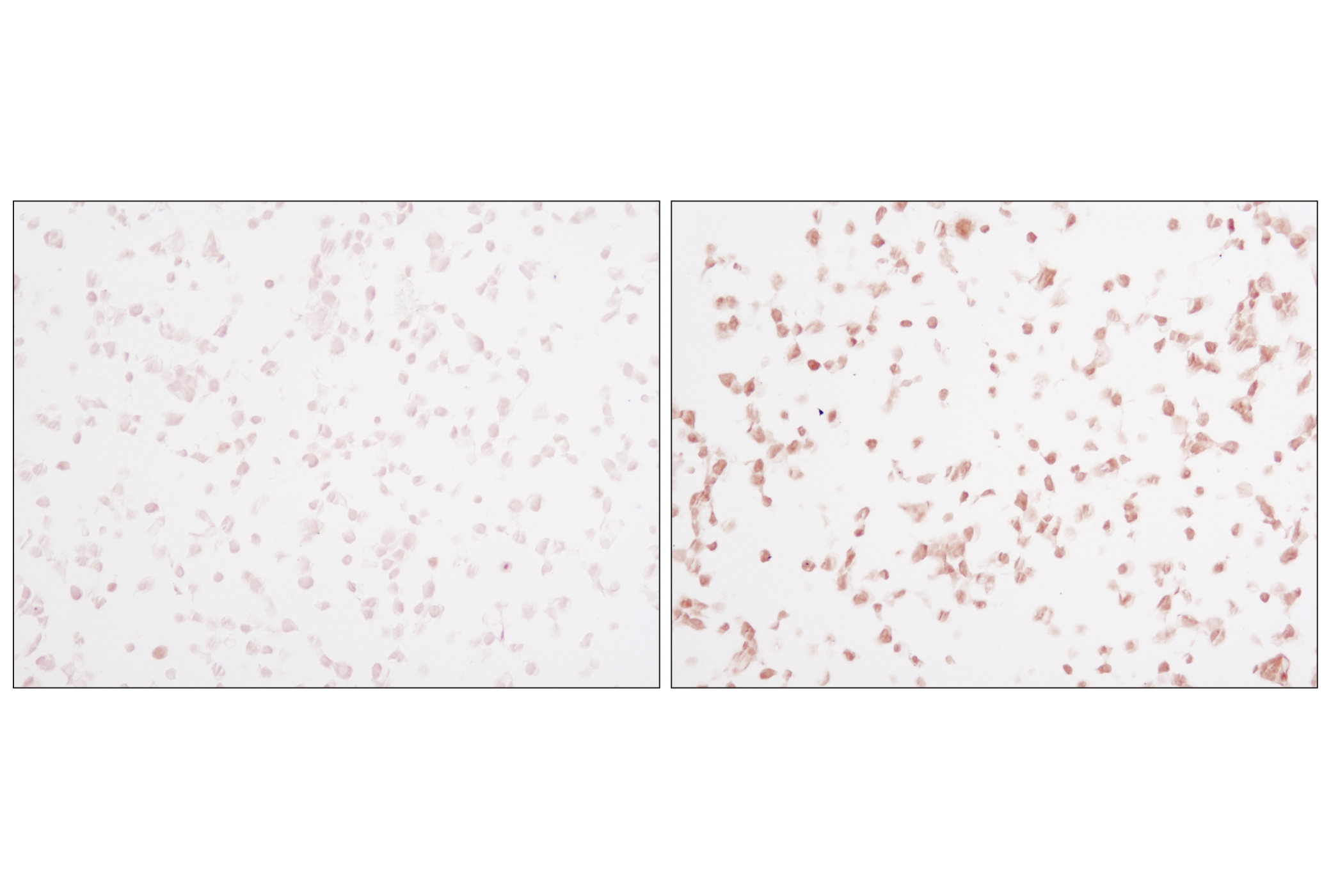  Image 6: PhosphoPlus® SAPK/JNK (Thr183/Tyr185) Antibody Duet