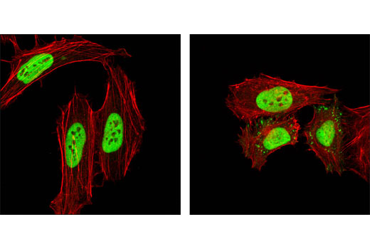 Immunofluorescence Image 1: hnRNP K (R332) Antibody