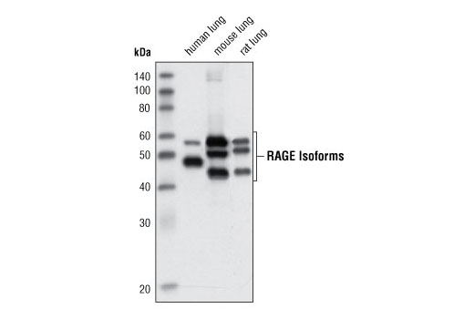 Western Blotting Image 1: RAGE Antibody