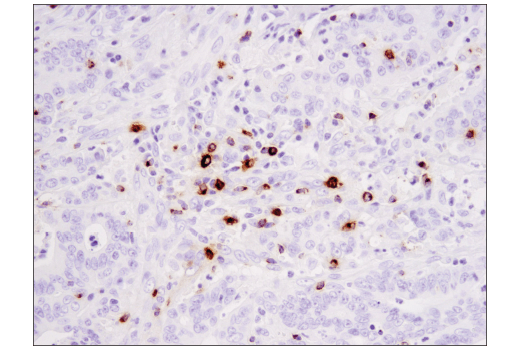 Immunohistochemistry Image 5: Granzyme B (D6E9W) Rabbit mAb