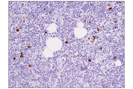 Immunohistochemistry Image 6: Granzyme B (D6E9W) Rabbit mAb
