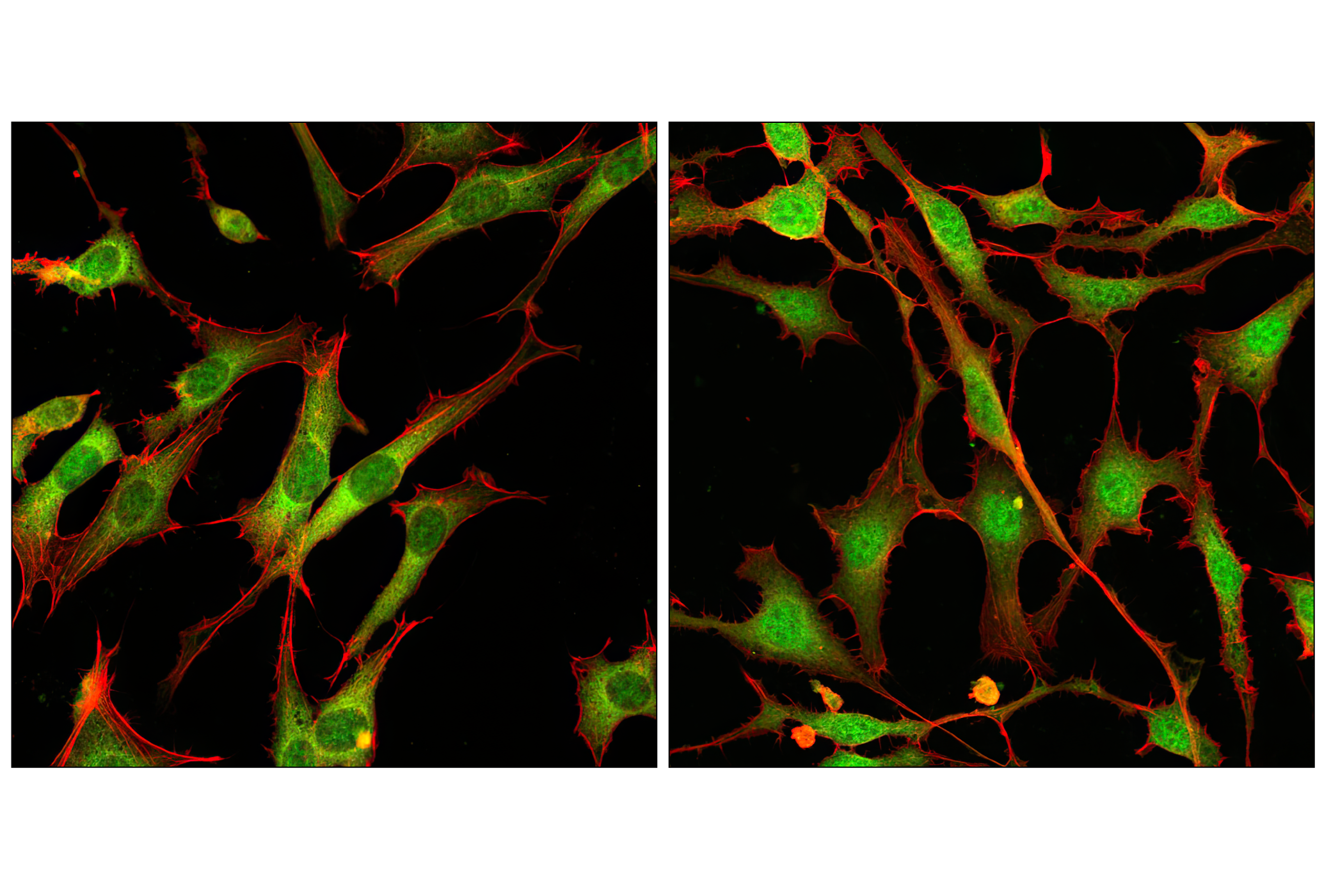 Immunofluorescence Image 1: p44/42 MAPK (Erk1/2) (137F5) Rabbit mAb