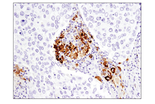 Immunohistochemistry Image 1: YKL-40 (E2L1M) Rabbit mAb
