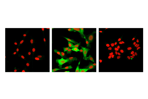 Immunofluorescence Image 1: TRAF1 (1F3) Rat mAb