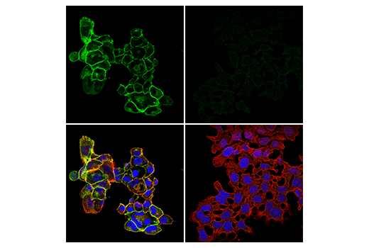 Immunofluorescence Image 1: ZIP8/SLC39A8 (E3V8K) Rabbit mAb
