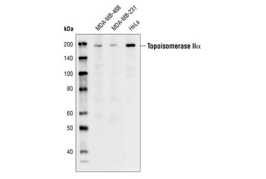 Western Blotting Image 1: Topoisomerase IIα Antibody